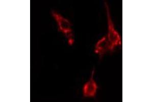 ABIN6274885 staining HepG2 cells by IF/ICC. (ABCD4 Antikörper  (Internal Region))