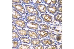 Immunohistochemistry of paraffin-embedded mouse Intestine using BMPR1B antibody. (BMPR1B Antikörper)