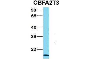 Host:  Rabbit  Target Name:  NOP56  Sample Type:  MCF7  Antibody Dilution:  1. (CBFA2T3 Antikörper  (N-Term))