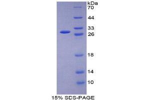 SDS-PAGE (SDS) image for Glutathione Reductase (GSR) (AA 7-246) protein (His tag) (ABIN2124999) (Glutathione Reductase Protein (GSR) (AA 7-246) (His tag))