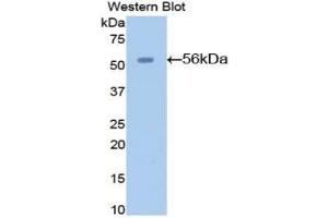 Detection of Recombinant AGT, Mouse using Polyclonal Antibody to Angiotensinogen (AGT) (AGT Antikörper  (AA 23-477))