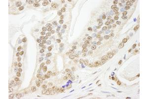 anti-PDS5, Regulator of Cohesion Maintenance, Homolog B (PDS5B) (AA 1200-1250) antibody