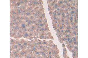 IHC-P analysis of Mouse Tissue, with DAB staining. (Vitamin D-Binding Protein Antikörper  (AA 395-473))