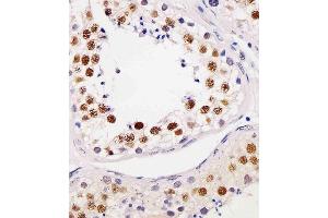 (ABIN6244015 and ABIN6577179) staining TE2IP in human testis tissue sections by Immunohistochemistry (IHC-P - paraformaldehyde-fixed, paraffin-embedded sections). (RAP1 Antikörper  (AA 1-399))