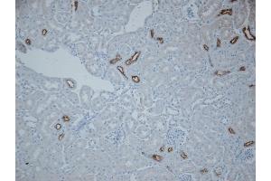 Immunohistochemistry analysis using Rabbit Anti-NCC Polyclonal Antibody (ABIN2486297). (SLC12A3 Antikörper  (AA 74-95) (PE))