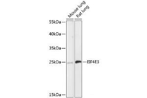 Western blot analysis of extracts of various cell lines using EIF4E3 Polyclonal Antibody at dilution of 1:3000. (EIF4E3 Antikörper)