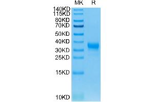 Human Fc gamma RIIA/CD32a (H167) on Tris-Bis PAGE under reduced condition. (FCGR2A Protein (AA 36-218) (His-Avi Tag))