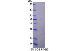 SDS-PAGE analysis of Mouse MRPL1 Protein. (MRPL1 Protein)