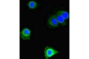 Immunofluorescent analysis of Hela cells using ABIN7150566 at dilution of 1:100 and Alexa Fluor 488-congugated AffiniPure Goat Anti-Rabbit IgG(H+L) (DOK2 Antikörper  (AA 123-412))