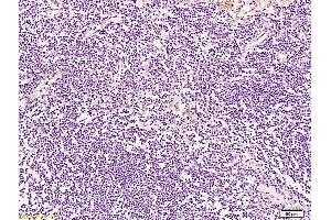 Formalin-fixed and paraffin embedded human lymph node tissue labeled with Anti-BRMS-1 Polyclonal Antibody, Unconjugated at 1:200 followed by conjugation to the secondary antibody and DAB staining (BRMS1L Antikörper  (AA 151-246))