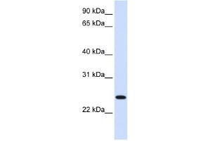 ORC6L antibody used at 1 ug/ml to detect target protein.