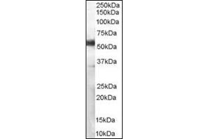 (1 µg/ml) Staining of Human Lymph Node lysate (35 µg protein in RIPA buffer). (CD14 Antikörper)