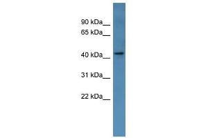 MAGEA11 antibody used at 0. (MAGEA11 Antikörper  (Middle Region))