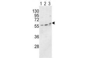 Western blot analysis of ALP / Alkaline Phosphatase antibody and MCF-7 (lane 1), HL-60 cell line (2) and mouse brain tissue (3) lysate. (ALPL Antikörper  (AA 3-32))