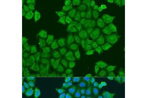 Immunofluorescence analysis of U2OS cells using STX12 Polyclonal Antibody at dilution of 1:100. (Syntaxin 12 Antikörper)