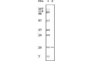 Western blot analysis using CD19 mouse mAb against CD19 recombinant protein. (CD19 Antikörper)