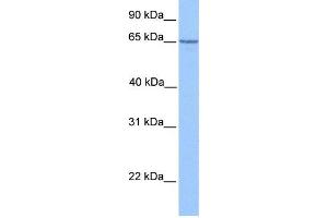 WB Suggested Anti-PML Antibody Titration:  1 ug/ml  Positive Control:  Hela cell lysate (PML Antikörper  (C-Term))