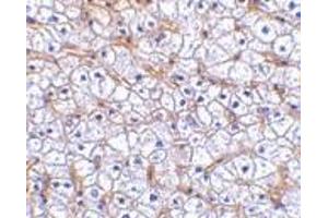 Immunohistochemistry of Fn14 in human liver tissue with Fn14 antibody at 2.