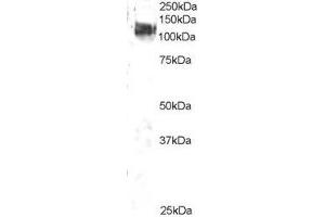 ABIN2561614 staining (2µg/ml) of 3T3 lysate (RIPA buffer, 35µg total protein per lane). (CBL Antikörper  (C-Term))