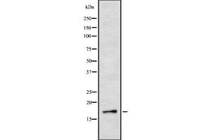 Western blot analysis IL3 using Jurkat whole cell lysates (IL-3 Antikörper  (Internal Region))