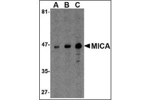 Western blot analysis of MICA in A-20 cell lysate with this product at (A) 0.