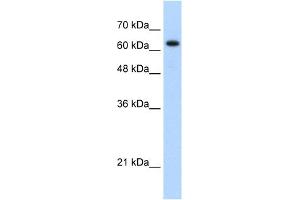 WB Suggested Anti-RAD17 Antibody Titration: 1. (RAD17 Antikörper  (C-Term))