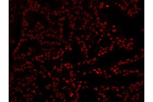 Immunofluorescence (IF) image for anti-5'-3' Exoribonuclease 2 (XRN2) (AA 900-950) antibody (ABIN7449038) (XRN2 Antikörper  (AA 900-950))