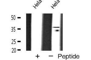 Western blot analysis of TBP expression in Hela cells (TBP Antikörper  (N-Term))
