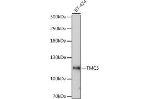 Tmc5 Antikörper  (AA 676-760)