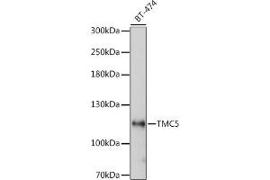 Western blot analysis of extracts of BT-474 cells, using TMC5 antibody (ABIN7270941) at 1:1000 dilution. (Tmc5 Antikörper  (AA 676-760))