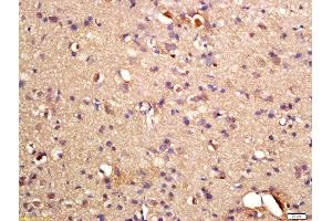 Formalin-fixed and paraffin embedded rat brain labeled with Rabbit Anti-phospho-GRLF1(Tyr1087) Polyclonal Antibody, Unconjugated (ABIN2174954) at 1:200 followed by conjugation to the secondary antibody and DAB staining (GRLF1 Antikörper  (pTyr1087))