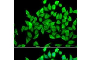 Immunofluorescence analysis of A549 cells using ALS2 Polyclonal Antibody (ALS2 Antikörper)
