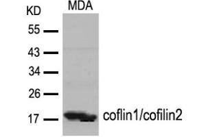 Image no. 2 for anti-Cofilin 1 (CFL1) (Tyr88) antibody (ABIN319381) (Cofilin Antikörper  (Tyr88))