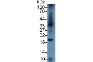 Detection of LAB7-1 in Mouse Spleen lysate using Polyclonal Antibody to B-Lymphocyte Activation Antigen B7-1 (LAB7-1) (CD80 Antikörper  (AA 38-246))