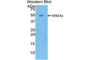 Western blot analysis of the recombinant protein. (HYAL1 Antikörper  (AA 52-462))