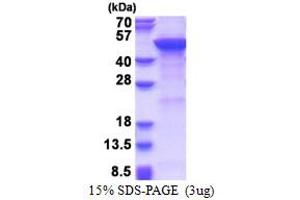 SDS-PAGE (SDS) image for Mannosyl (Alpha-1,6-)-Glycoprotein beta-1,2-N-Acetylglucosaminyltransferase (MGAT2) (AA 30-447) protein (His tag) (ABIN5853617) (MGAT2 Protein (AA 30-447) (His tag))