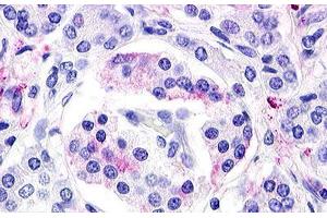 Image no. 1 for anti-G Protein-Coupled Receptor 119 (GPR119) (Cytoplasmic Domain) antibody (ABIN1048700) (G Protein-Coupled Receptor 119 Antikörper  (Cytoplasmic Domain))