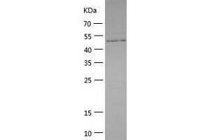 CARD14 Protein (AA 2-434) (His tag)