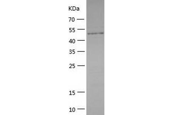 CARD14 Protein (AA 2-434) (His tag)