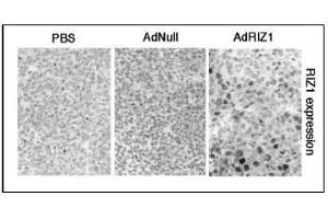 Image no. 2 for anti-PR Domain Containing 2, with ZNF Domain (PRDM2) (AA 245-573) antibody (ABIN356710) (PRDM2 Antikörper  (AA 245-573))
