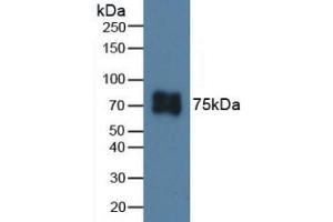 Detection of ITGb6 in Porcine Skin Tissue using Polyclonal Antibody to Integrin Beta 6 (ITGb6) (ITGB6 Antikörper  (AA 131-371))