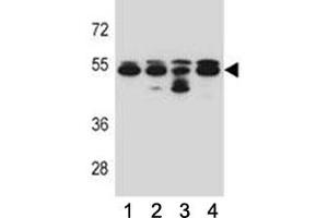 TUBB8 antibody western blot analysis in 293, A549, HepG2, K562 lysate. (Tubulin, beta 8 Antikörper  (AA 34-62))