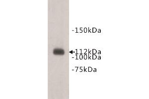 Western Blotting (WB) image for anti-Transmembrane Protein 67 (TMEM67) antibody (ABIN1854943) (TMEM67 Antikörper)