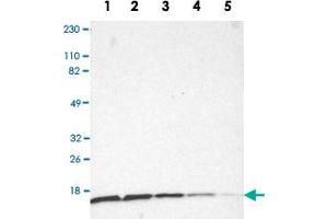 Western Blot analysis of Lane 1: RT-4, Lane 2: U-251MG sp, Lane 3: A-431, Lane 4: human liver and Lane 5: human tonsil lysates with RPS20 polyclonal antibody . (RPS20 Antikörper)