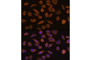 Immunofluorescence analysis of L929 cells using DOCK2 Rabbit pAb (ABIN1679578, ABIN5664348 and ABIN5664349) at dilution of 1:100 (40x lens). (DOCK2 Antikörper  (AA 1551-1830))