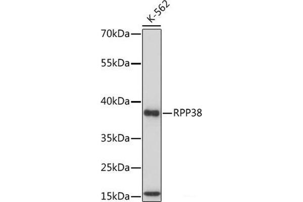 RPP38 Antikörper