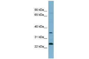 WB Suggested Anti-NOSIP Antibody Titration: 0. (NOSIP Antikörper  (N-Term))