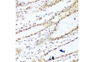 Immunohistochemistry of paraffin-embedded human stomach using HDAC1 antibody. (HDAC1 Antikörper  (AA 393-482))
