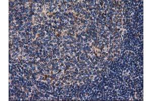 Image no. 15 for anti-Destrin (Actin Depolymerizing Factor) (DSTN) antibody (ABIN1497910) (Destrin Antikörper)