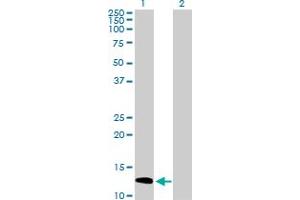 Western Blot analysis of SH2D1A expression in transfected 293T cell line by SH2D1A MaxPab polyclonal antibody.